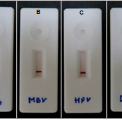 Novel patented diagnostic tool for WSSV to boost shrimp farming