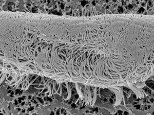 EU-funded fish parasite solution raises 1.4 million in seed financing