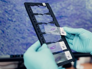 Chilean pathology company opens lab in Scotland